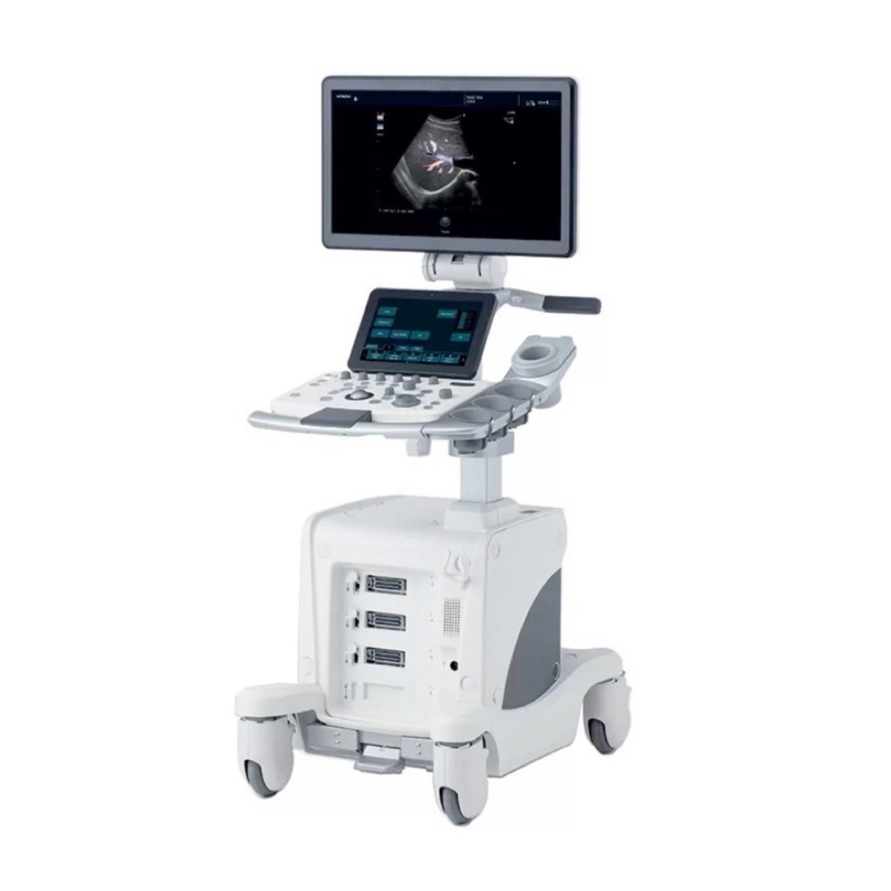 もりのさと整形外科クリニック_超音波診断装置